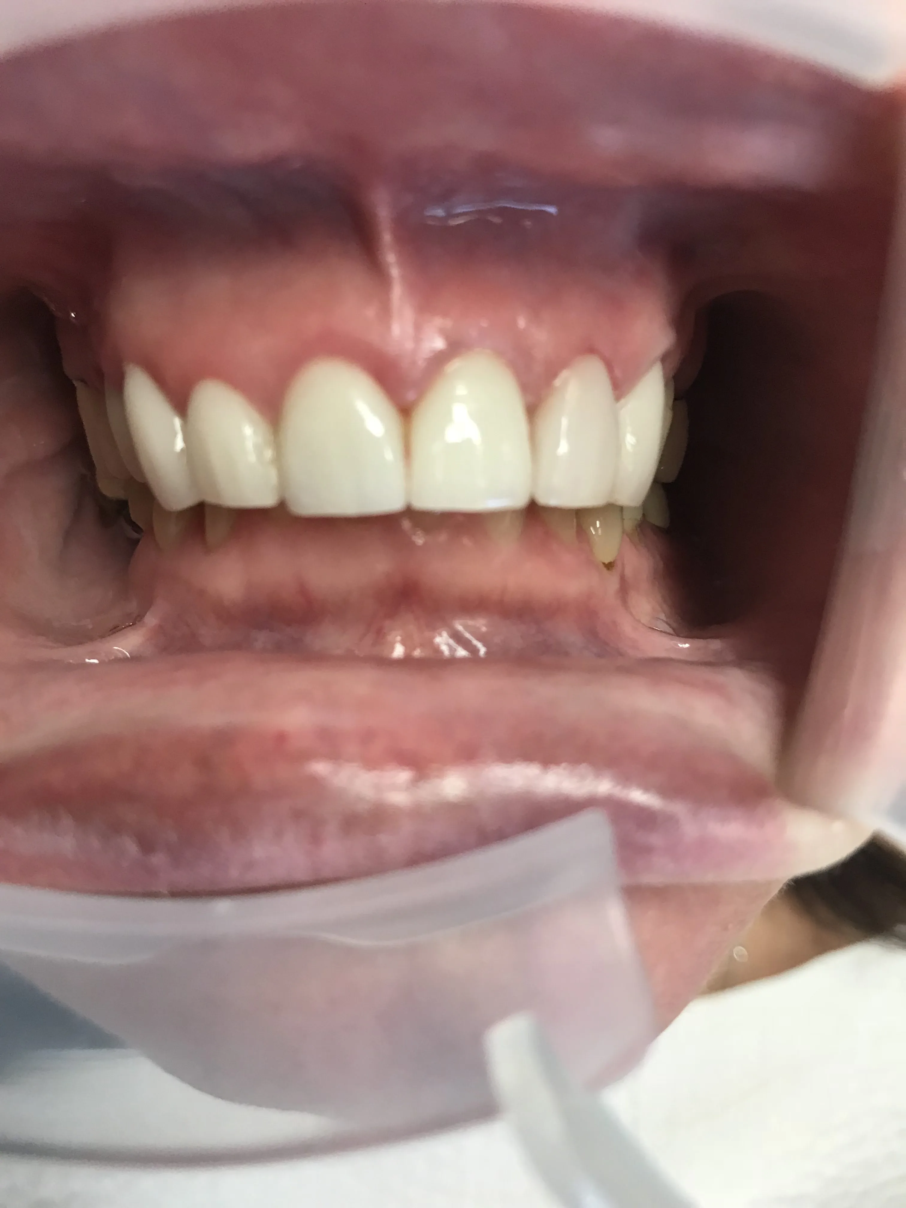 28415 oral hygiene practices