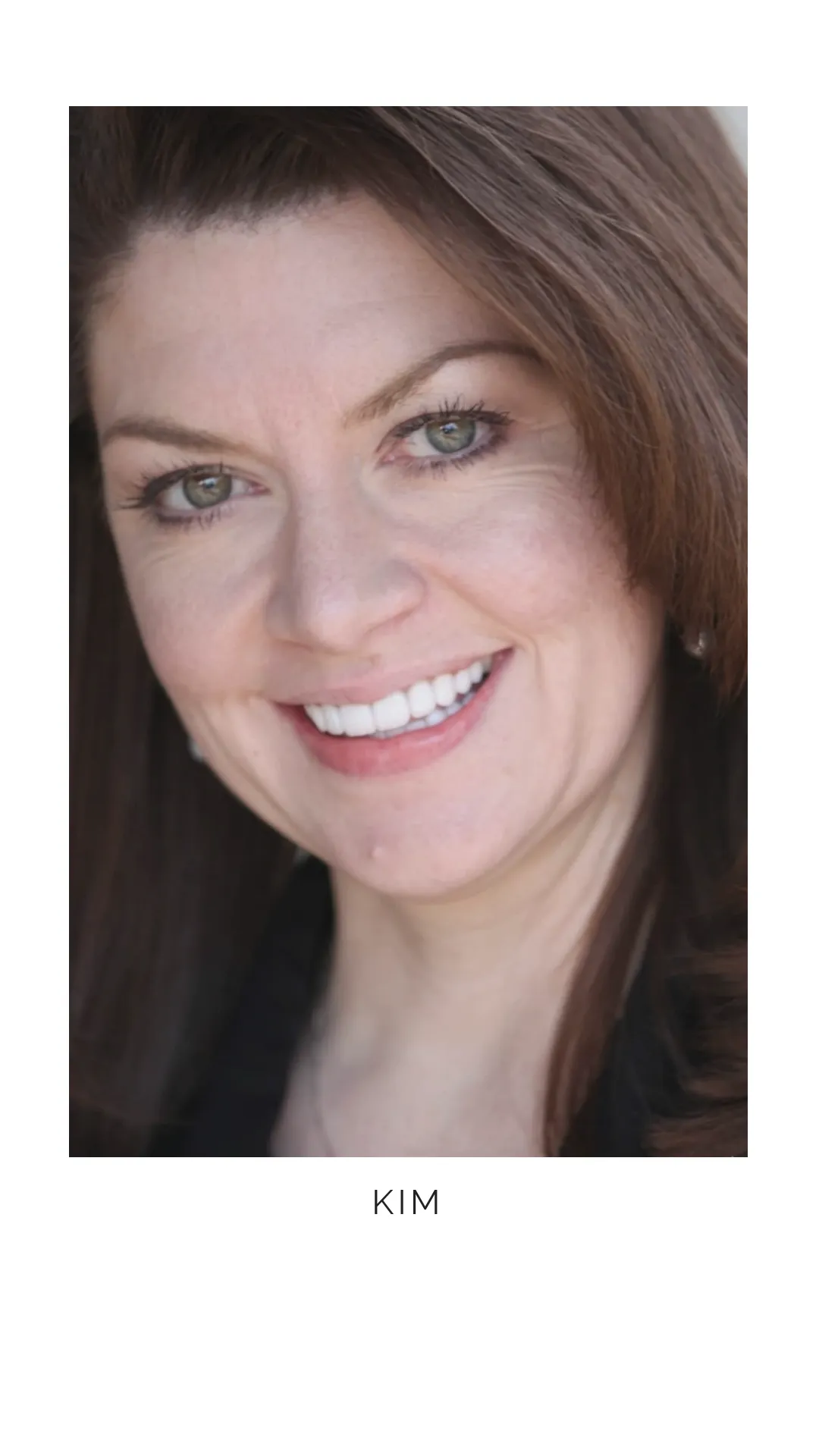 28420 zoom whitening results