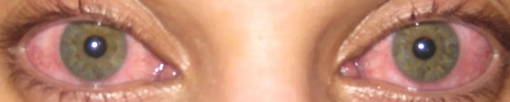 28426 i brite whitening cost 4