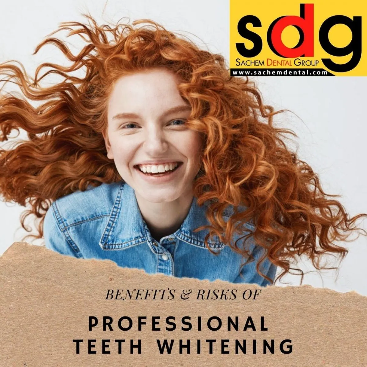 28427 tooth sensitivity