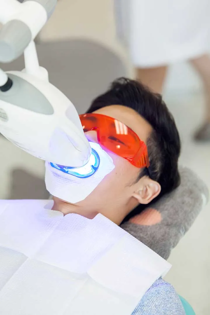 28428 at home whitening kits