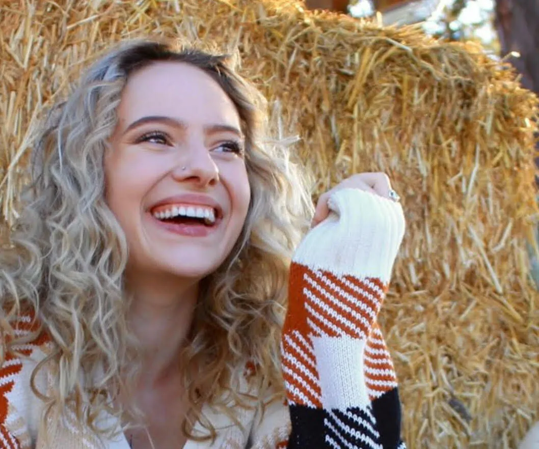 28443 in office teeth whitening