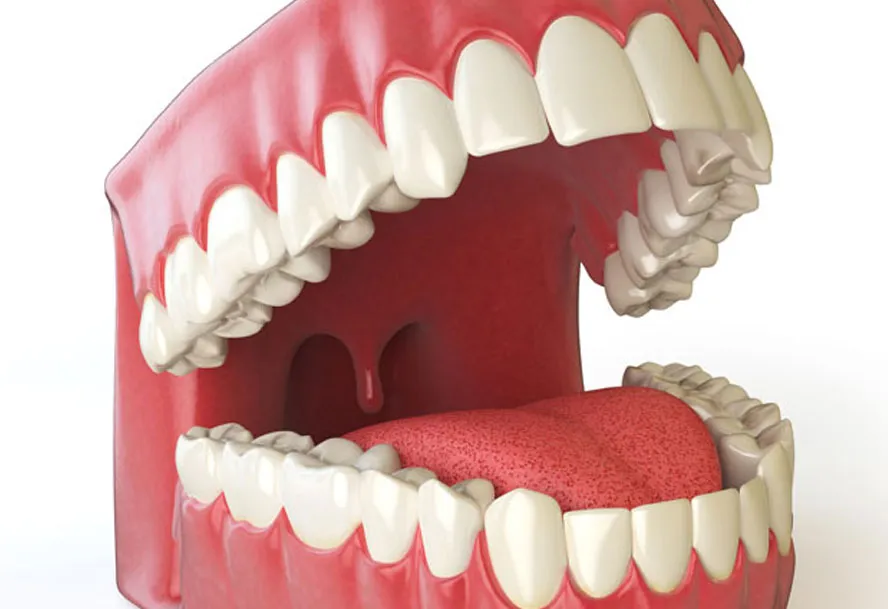 28443 teeth whitening before after