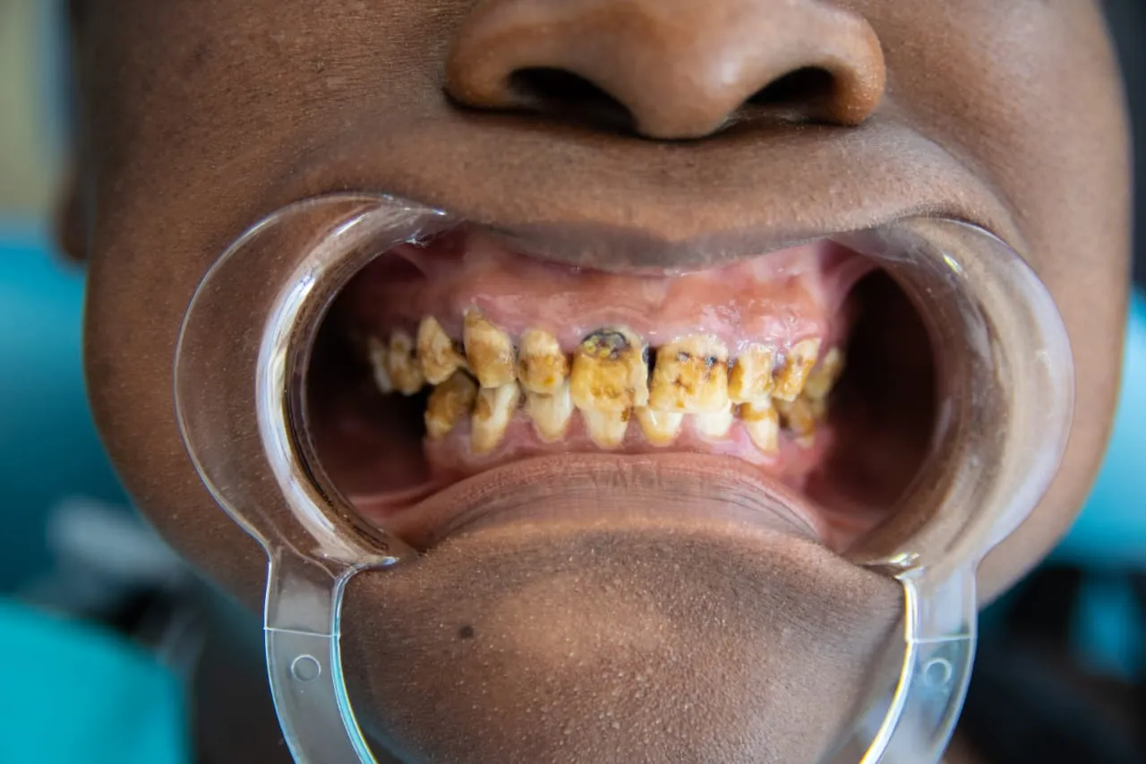 /img/28444-teeth-whitening-nairobi-smile.webp