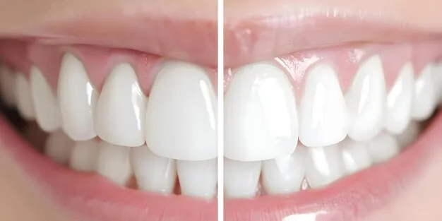 28447 at home teeth whitening