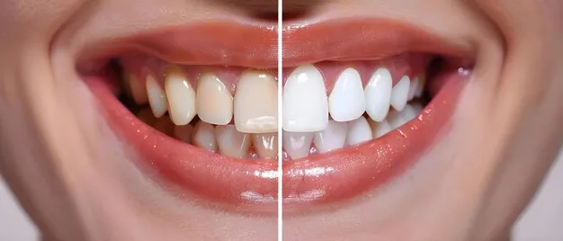 28447 professional teeth whitening