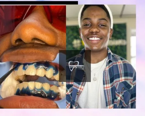 28457 qualified dentist indianapolis