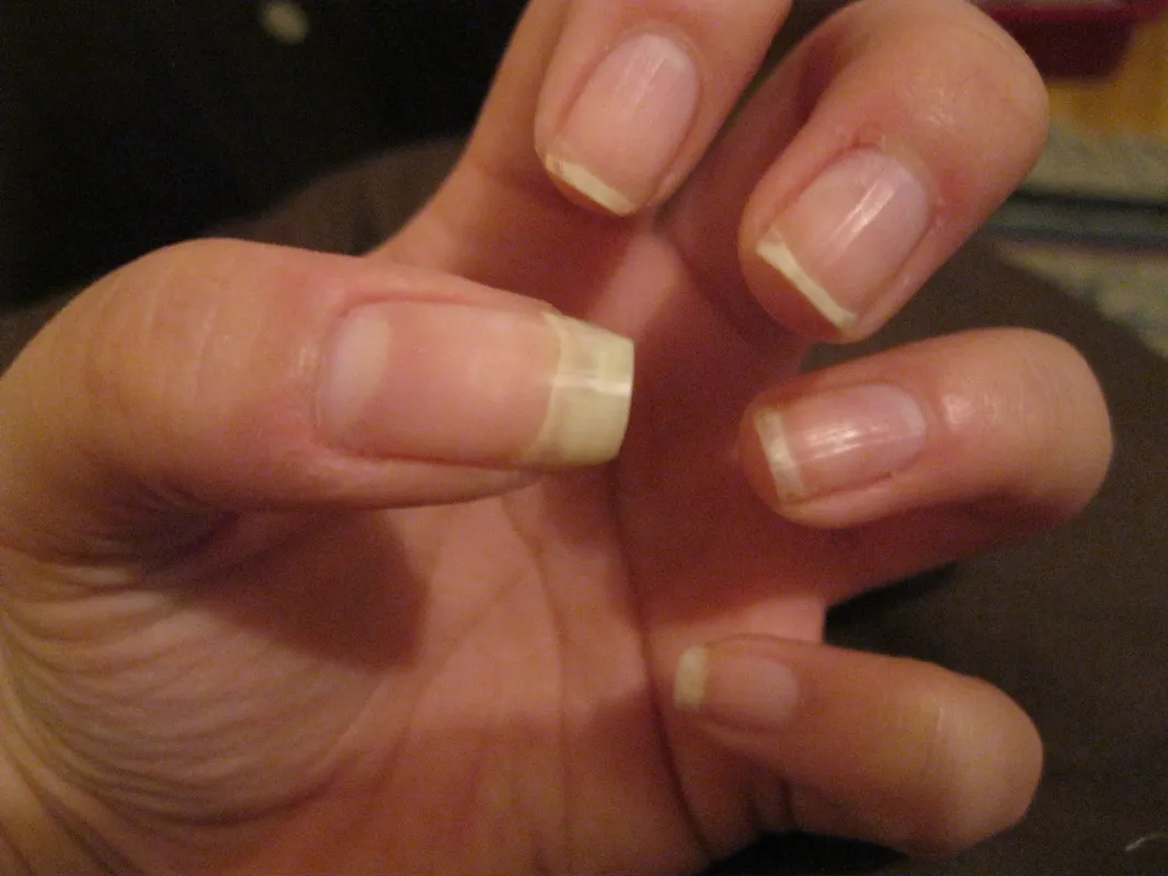 28465 natural nail whitening image1