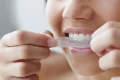 28467 tanden whitening strips stain removal