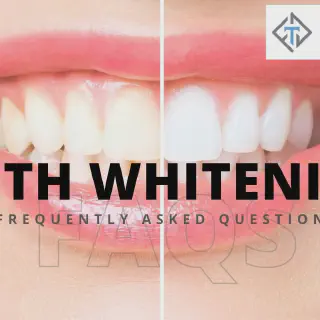 /img/28470-teeth-whitening-savannah-ga-image8.webp