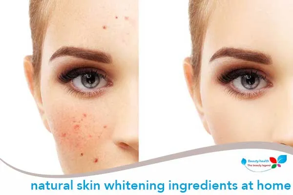 /img/28472-skin-whitening-tips.webp
