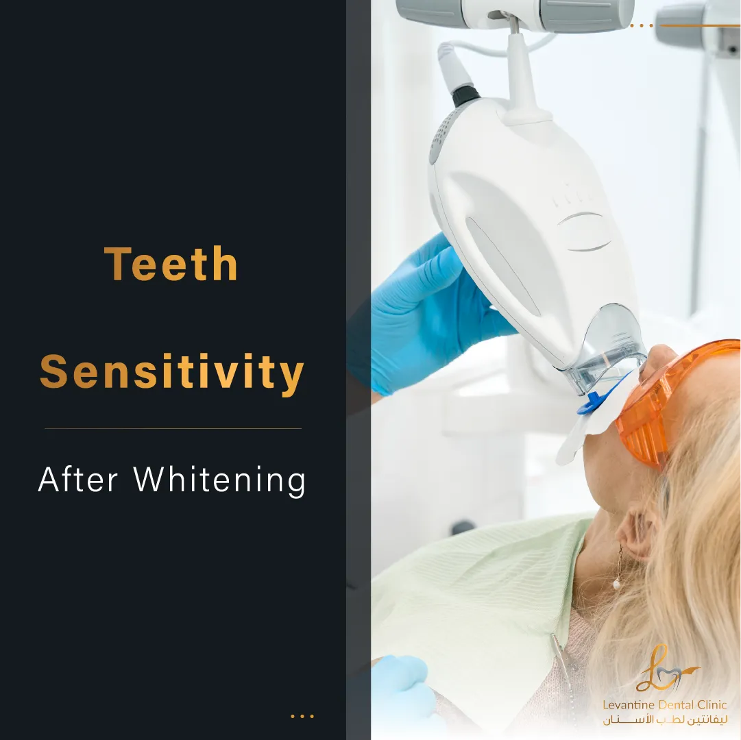 28475 teeth whitening sensitivity 6