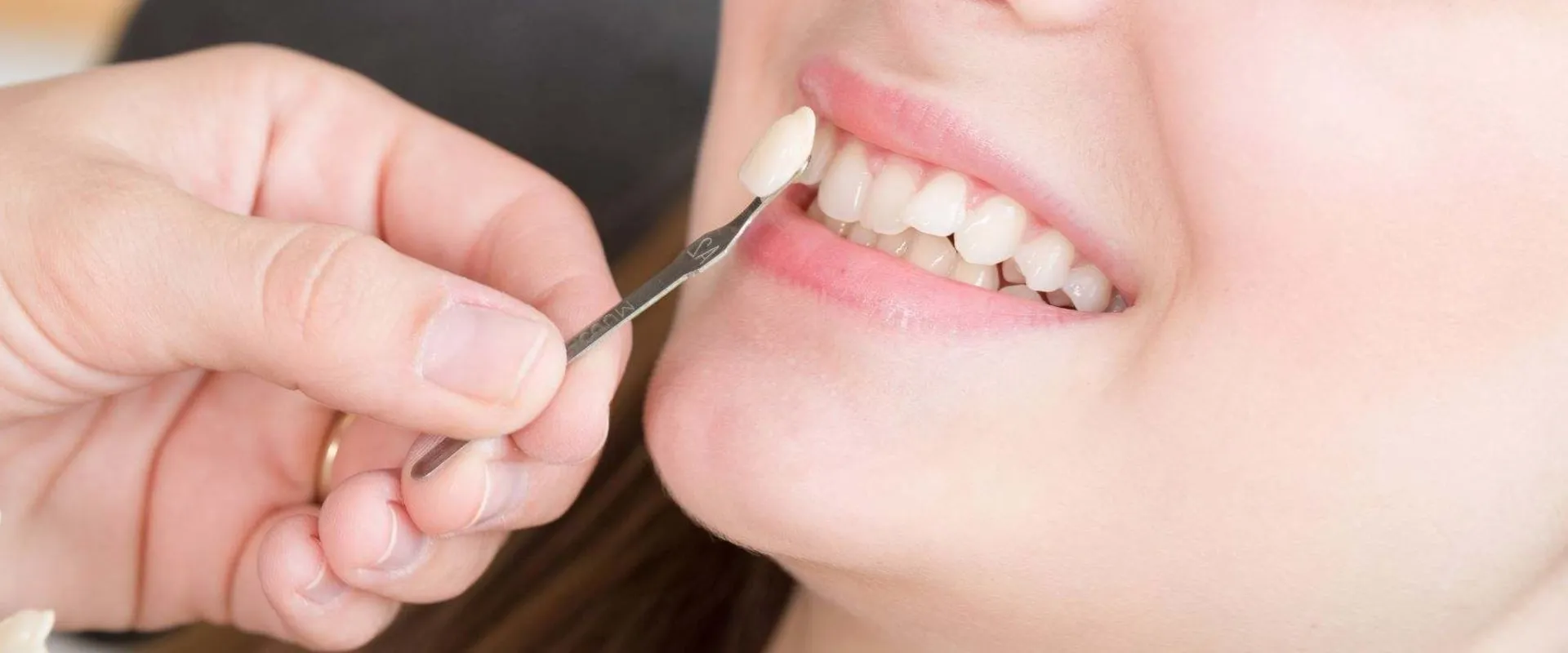 28480 sensitivity causes