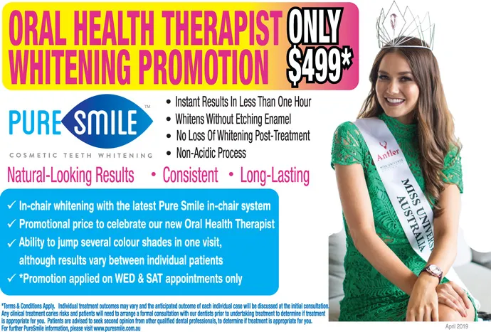 28497 at home teeth whitening kits