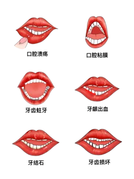 28500 teeth whitening canker sores overview