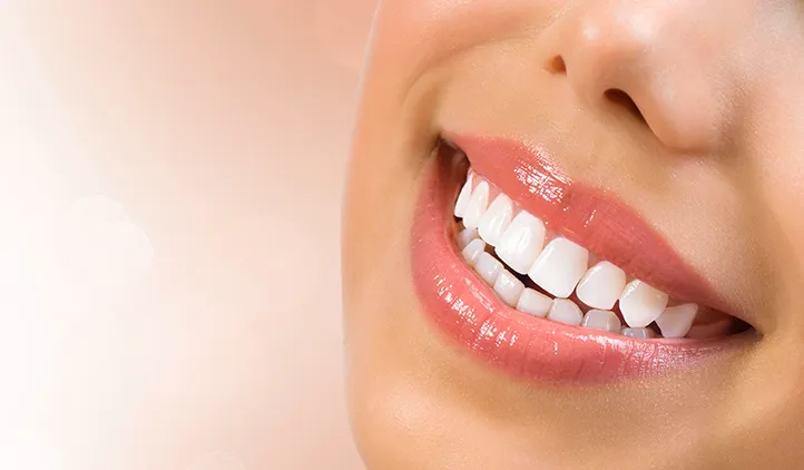 28505 teeth whitening before after