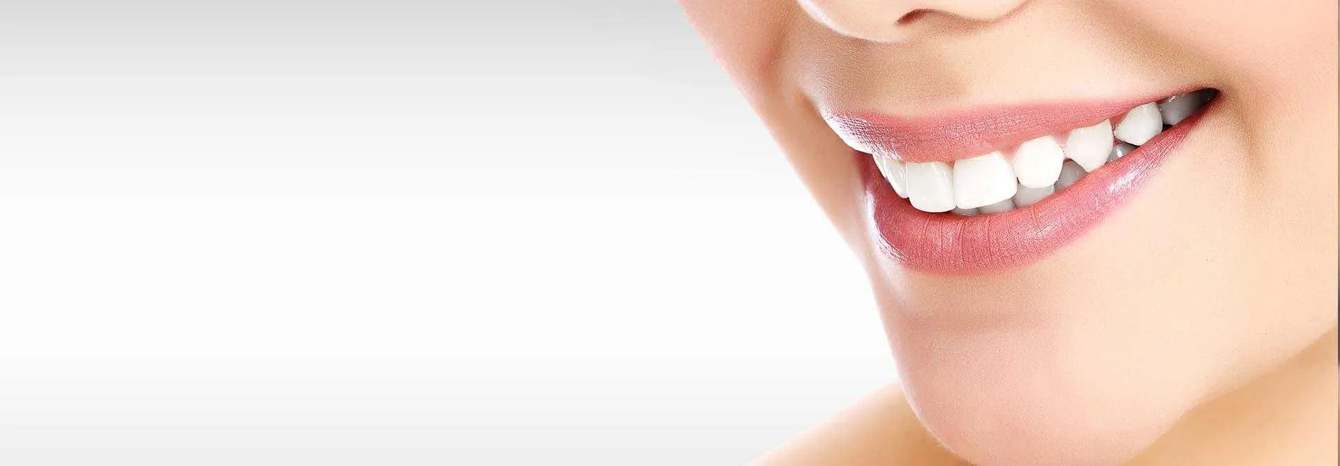 28516 at home teeth whitening