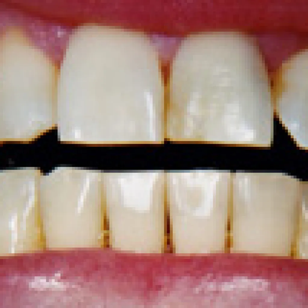 28528 desensitizing toothpaste