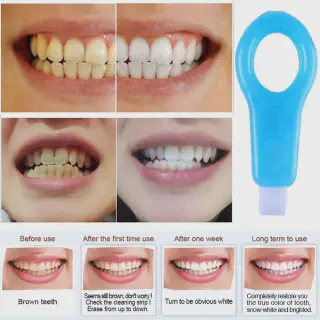 /img/28531-nano-teeth-whitening-kit-image7.webp