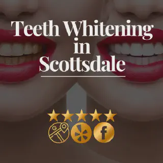 /img/28533-teeth-whitening-scottsdale-avoid-mistakes.webp