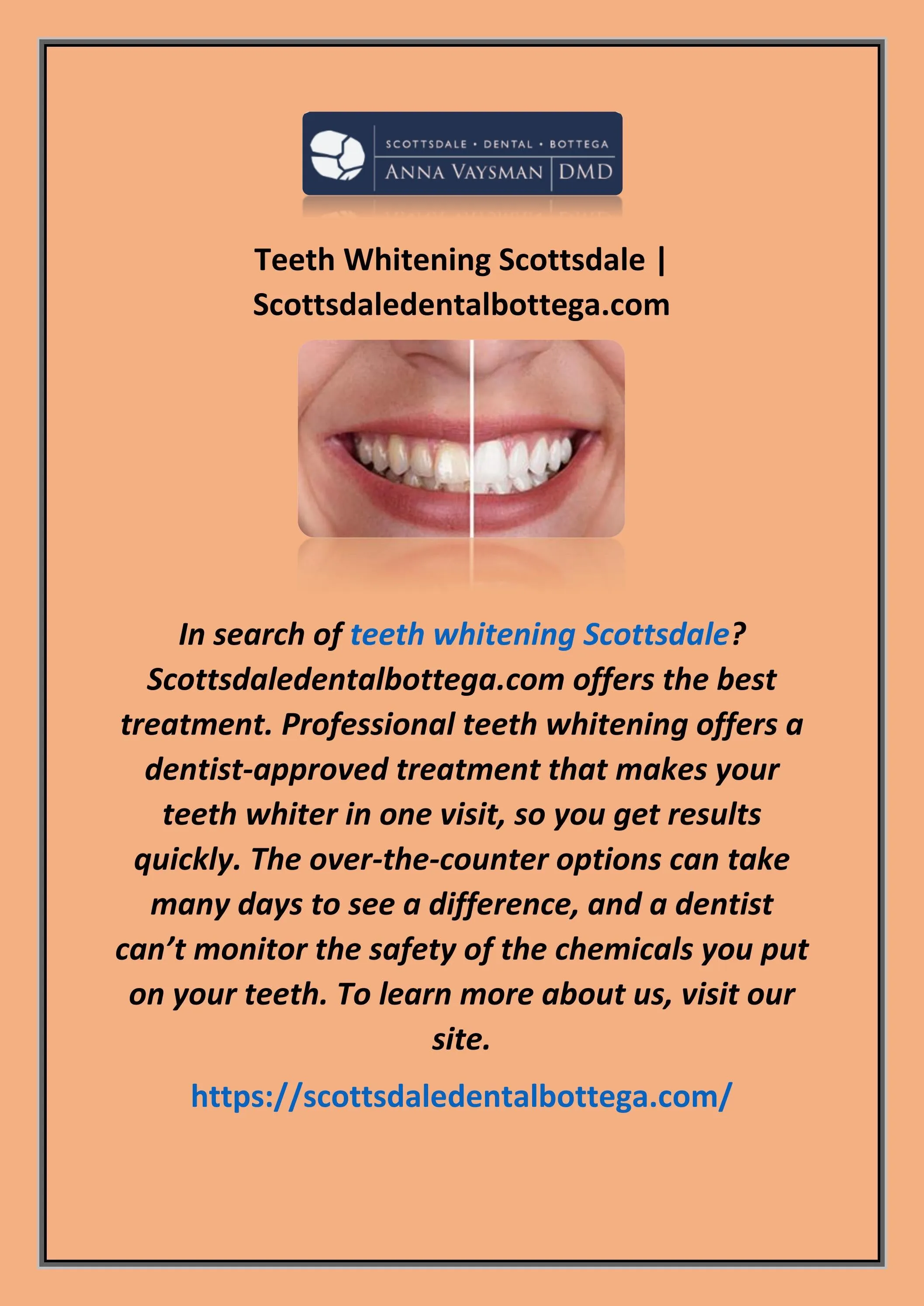 28533 teeth whitening scottsdale maintenance
