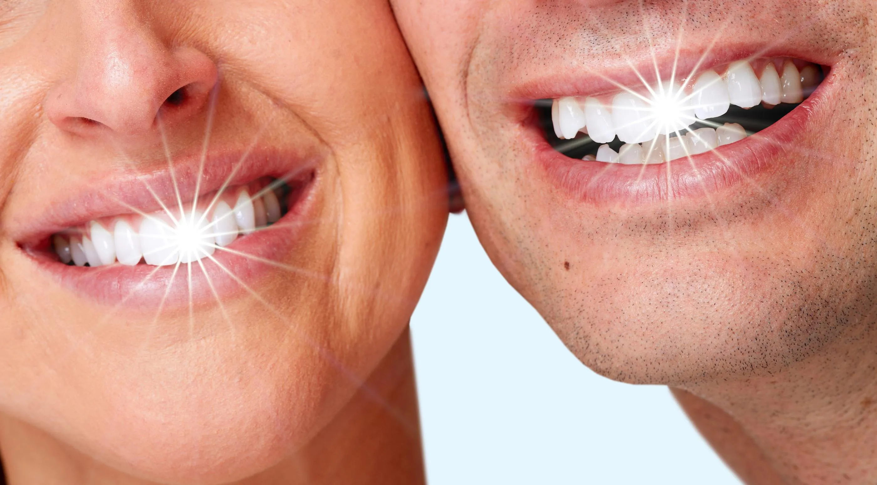 28536 teeth whitening before after