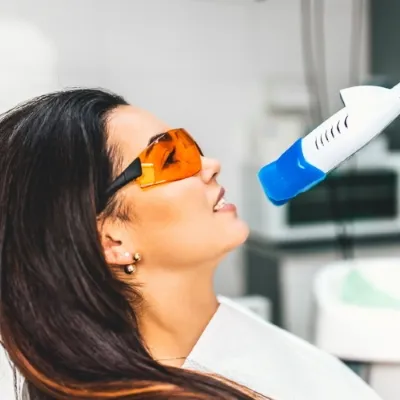 28544 at home teeth whitening