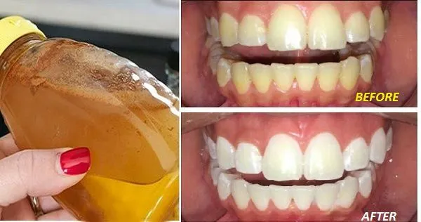 28545 healthy teeth