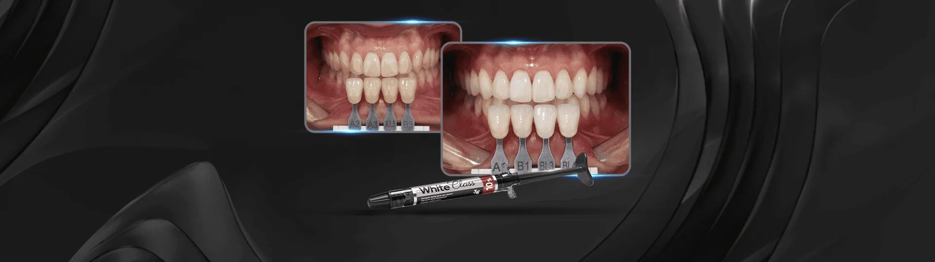 28551 alternative teeth whitening