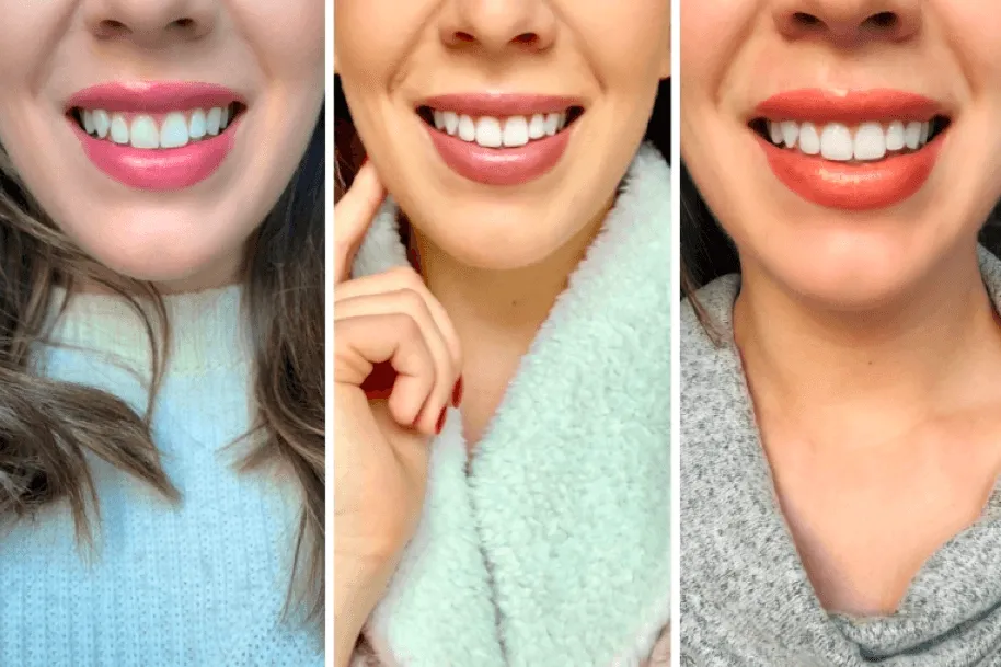 28554 cavities and toothache