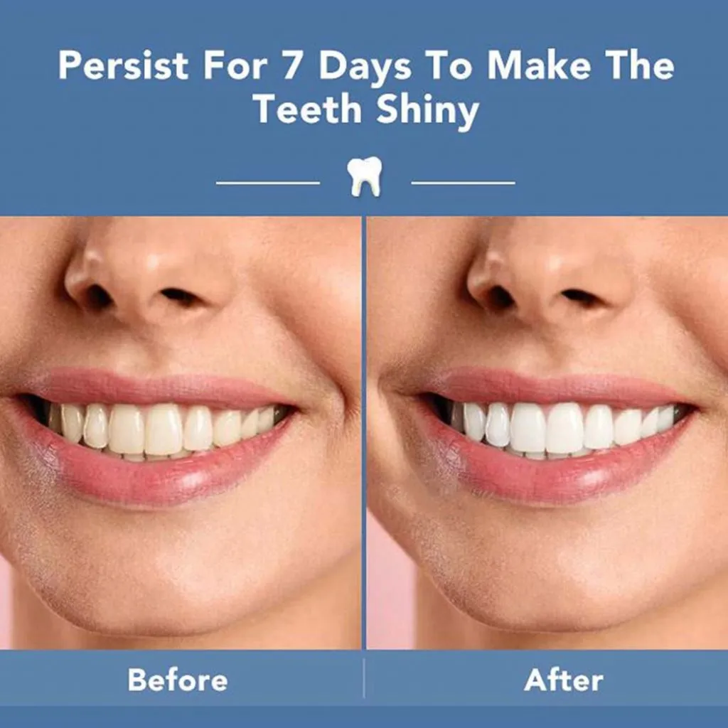 28554 enamel erosion