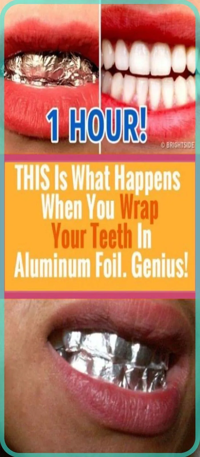 28555 activated charcoal