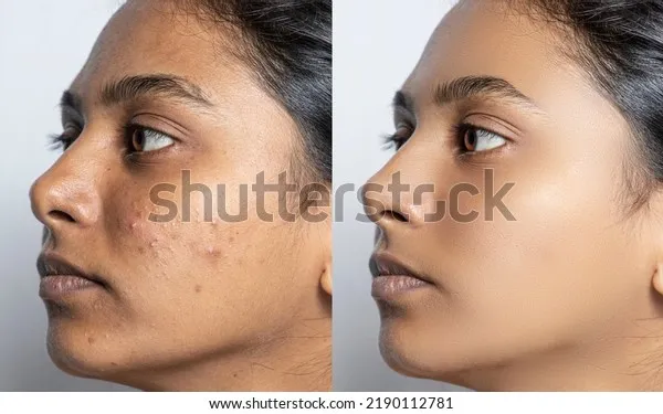 28565 hyperpigmentation causes