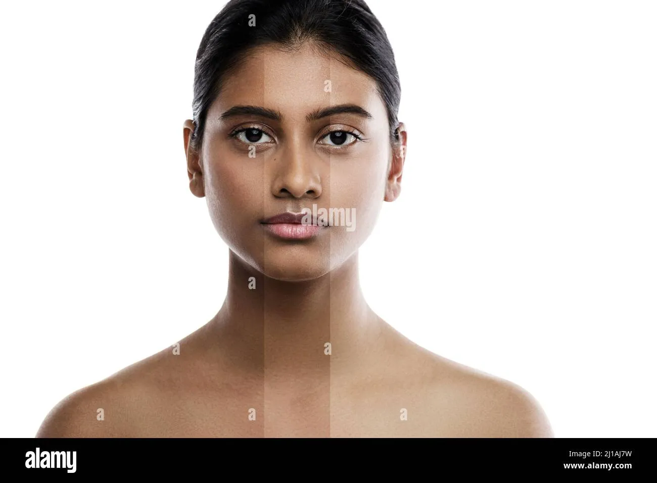 28565 laser skin brightening