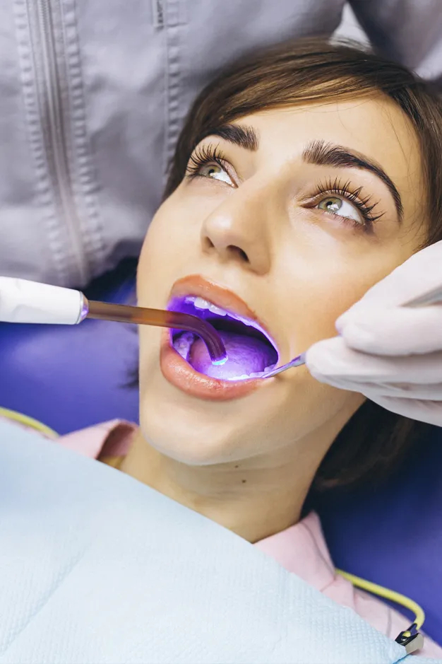 28592 teeth whitening lakewood before after