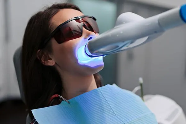 28610 in office teeth whitening