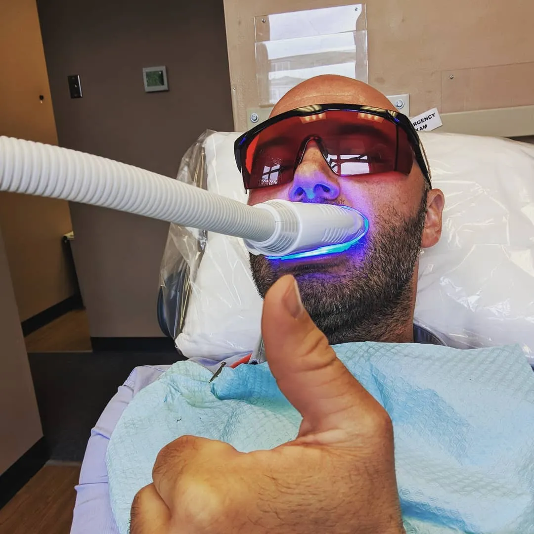 28610 teeth whitening cost