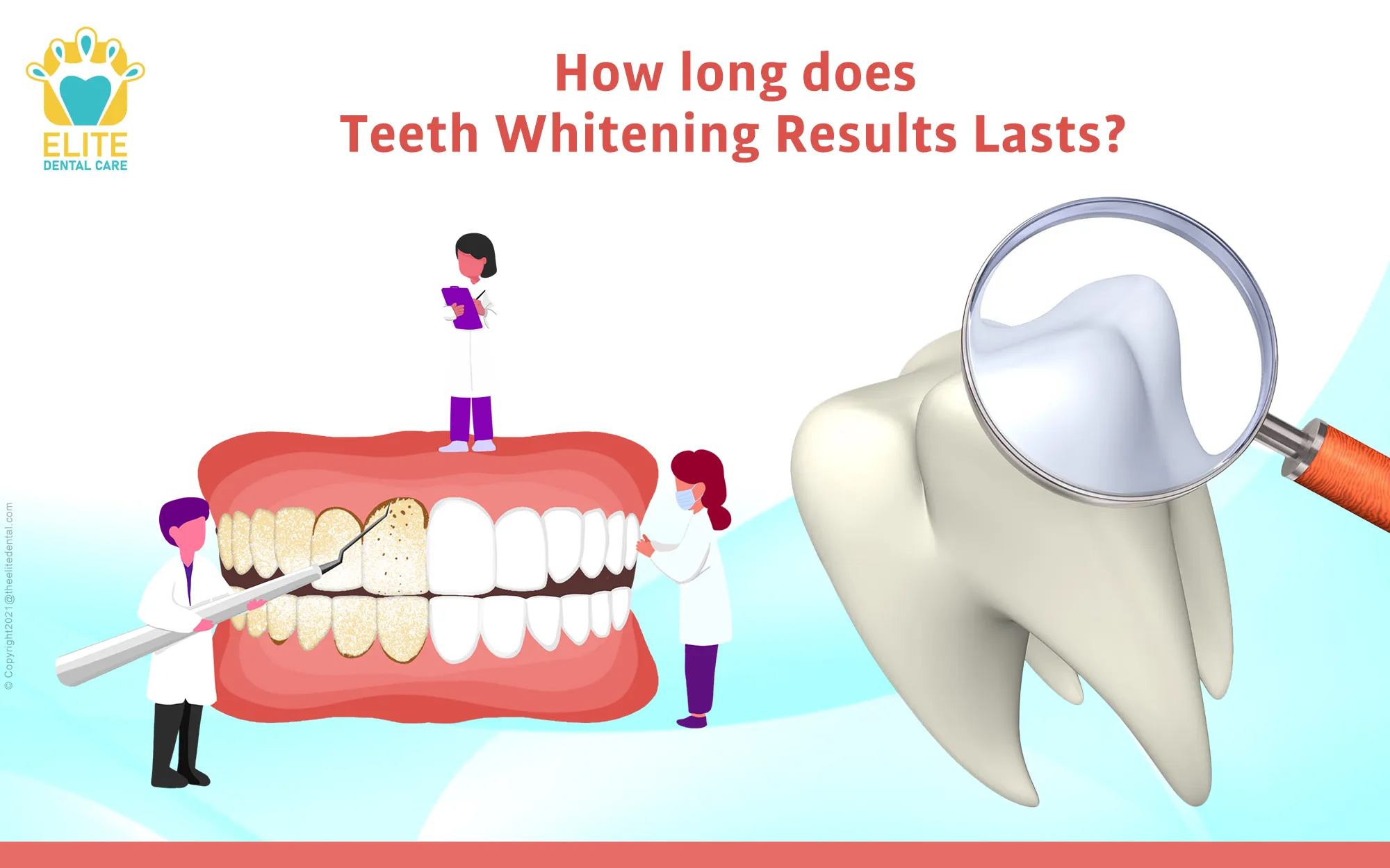 28617 teeth whitening results