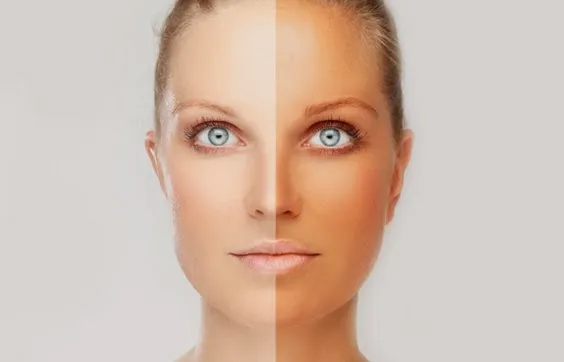 28644 melanin in skin