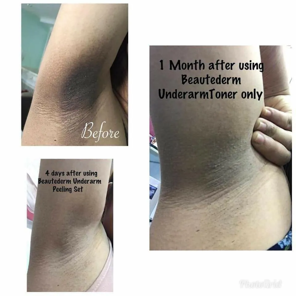 28663 deodorant effects