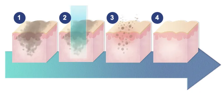 28663 whitening creams