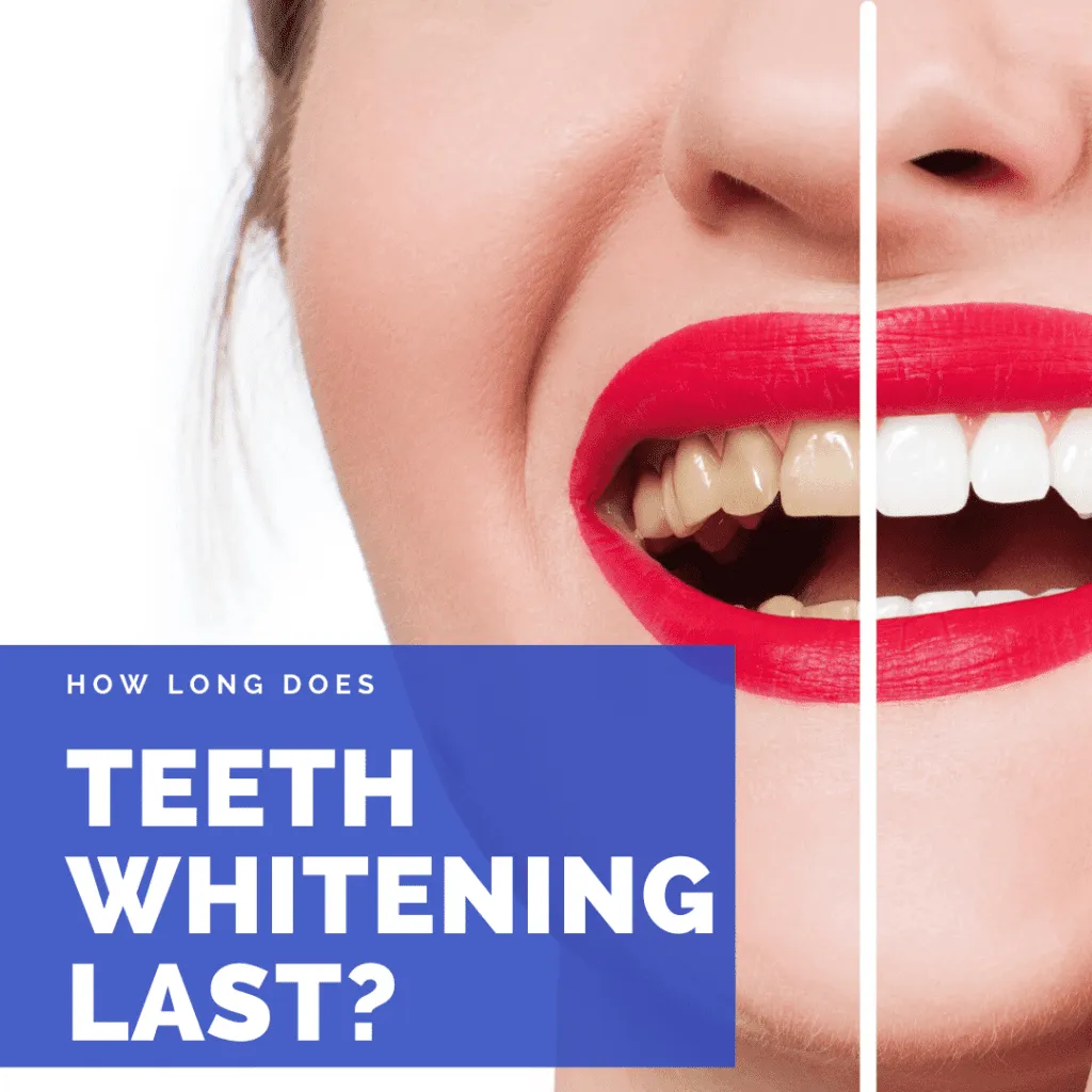 28678 types of whitening gel