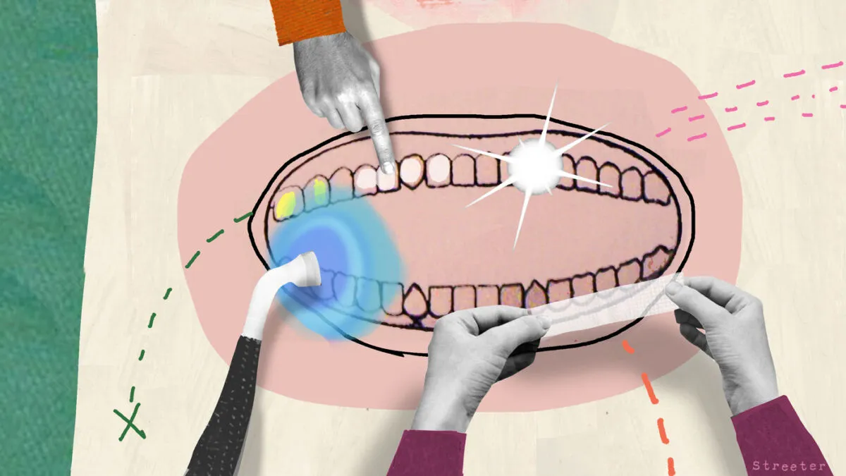 28679 teeth whitening business image3