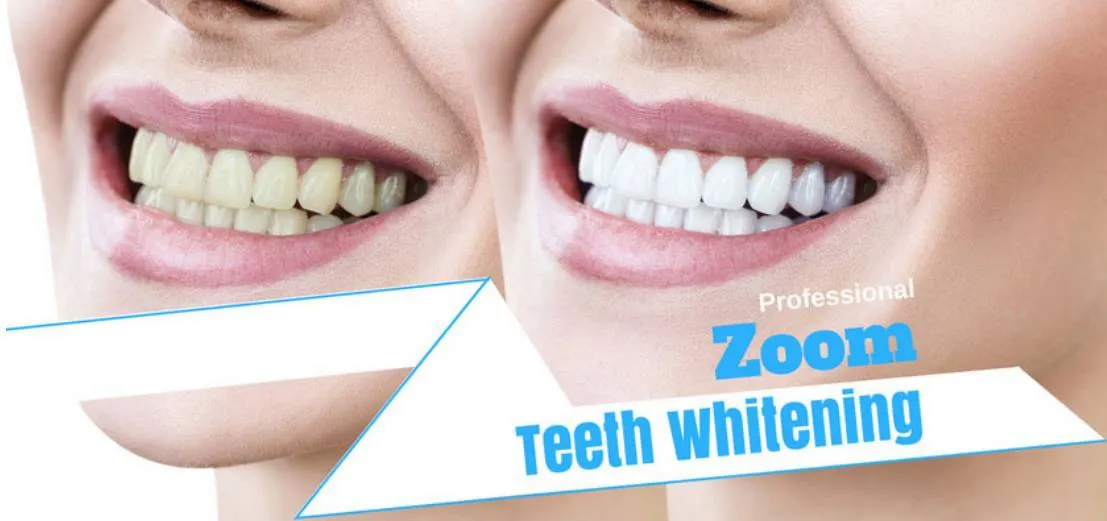28680 zoom teeth whitening melbourne healthy diet