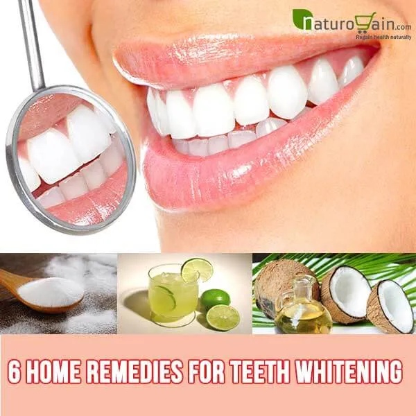 28691 stained teeth causes