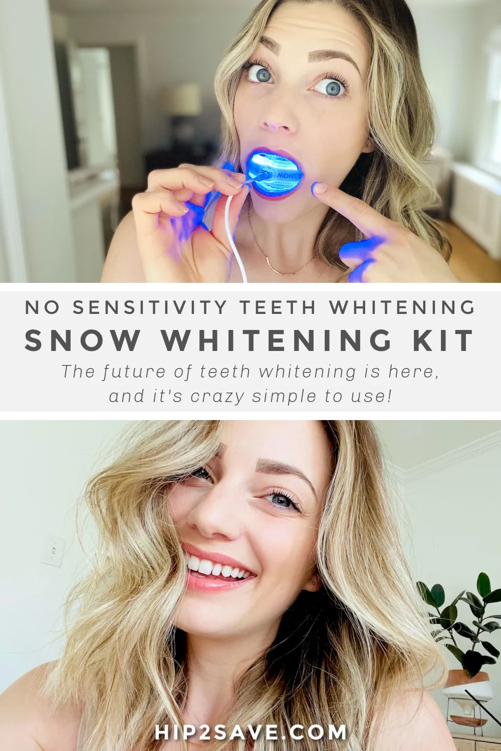 28695 white smile maintenance
