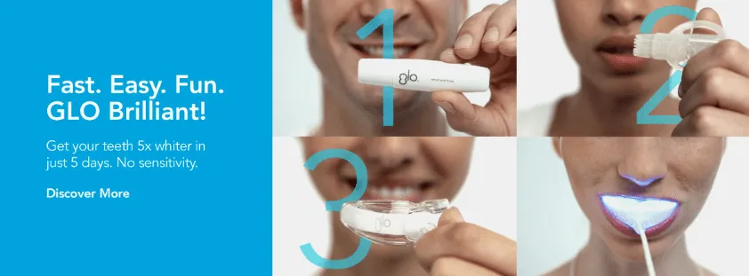 28697 teeth whitening before after