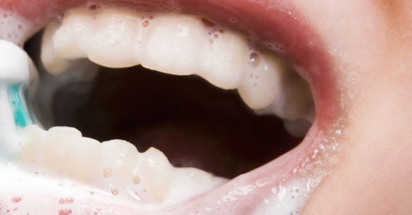 28700 baking soda cavity prevention