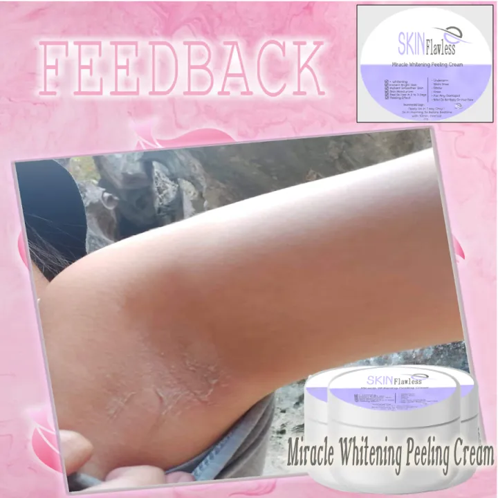 28713 alternative underarm whitening