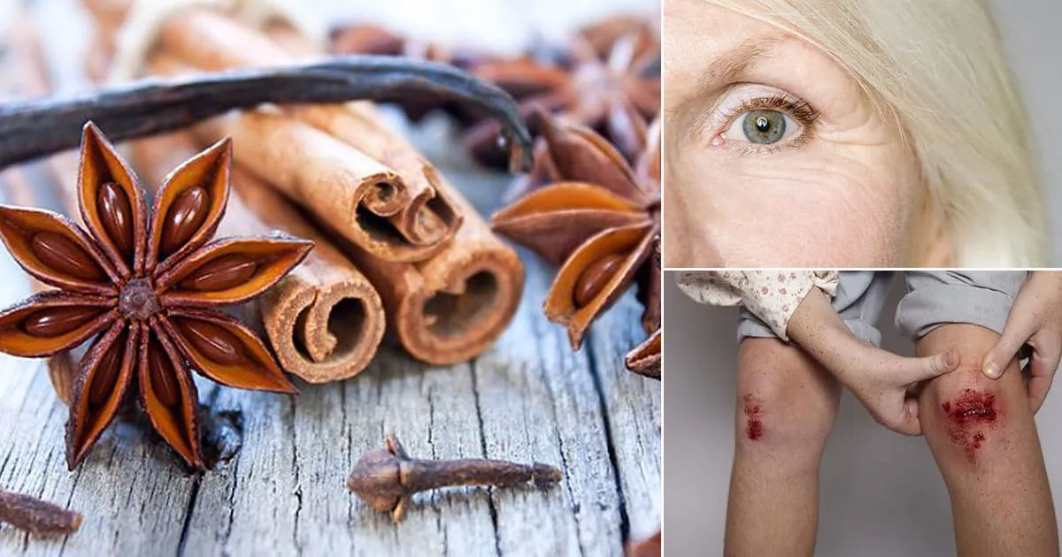 28719 star anise mask